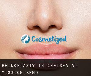 Rhinoplasty in Chelsea at Mission Bend