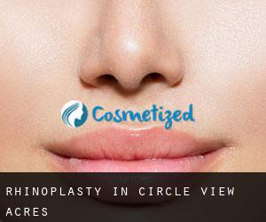 Rhinoplasty in Circle View Acres