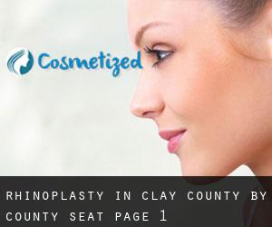 Rhinoplasty in Clay County by county seat - page 1