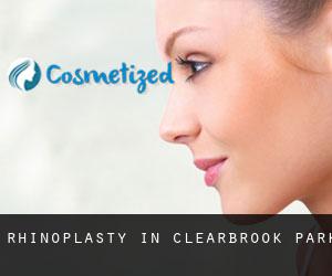 Rhinoplasty in Clearbrook Park