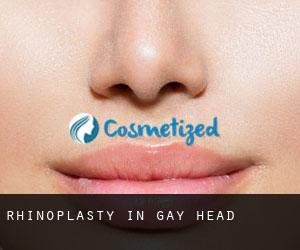 Rhinoplasty in Gay Head