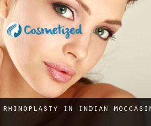 Rhinoplasty in Indian Moccasin