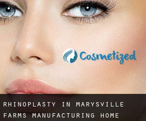 Rhinoplasty in Marysville Farms Manufacturing Home Community