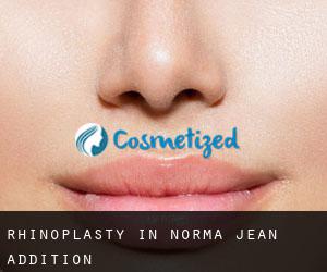 Rhinoplasty in Norma Jean Addition