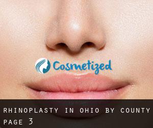 Rhinoplasty in Ohio by County - page 3