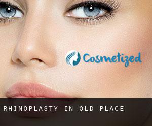 Rhinoplasty in Old Place