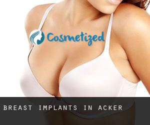 Breast Implants in Acker