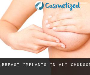 Breast Implants in Ali Chukson
