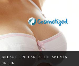 Breast Implants in Amenia Union