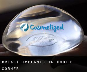 Breast Implants in Booth Corner