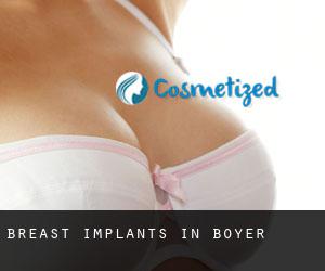 Breast Implants in Boyer