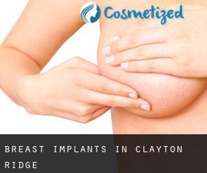 Breast Implants in Clayton Ridge