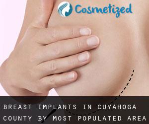 Breast Implants in Cuyahoga County by most populated area - page 1