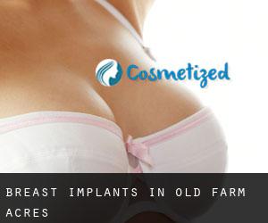 Breast Implants in Old Farm Acres