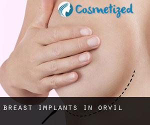 Breast Implants in Orvil