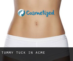 Tummy Tuck in Acme