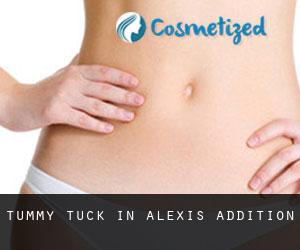 Tummy Tuck in Alexis Addition