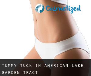 Tummy Tuck in American Lake Garden Tract