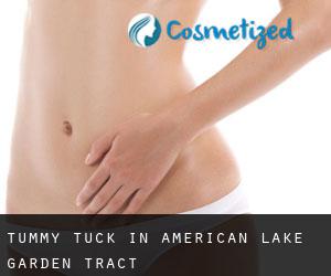 Tummy Tuck in American Lake Garden Tract