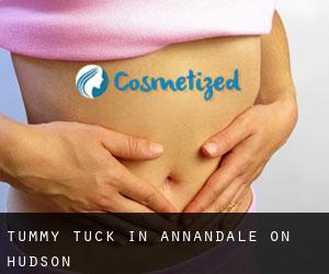 Tummy Tuck in Annandale-on-Hudson