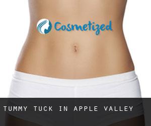 Tummy Tuck in Apple Valley