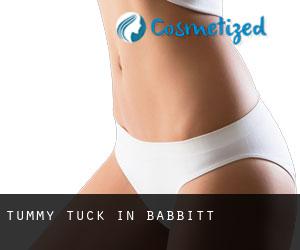 Tummy Tuck in Babbitt