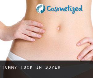 Tummy Tuck in Boyer