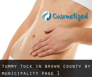 Tummy Tuck in Brown County by municipality - page 1