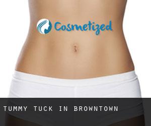Tummy Tuck in Browntown