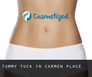 Tummy Tuck in Carmen Place