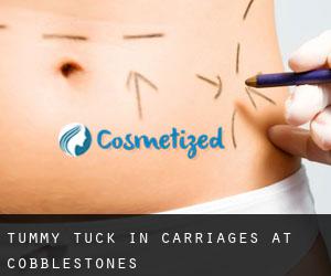 Tummy Tuck in Carriages at Cobblestones
