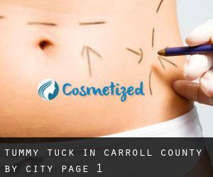 Tummy Tuck in Carroll County by city - page 1