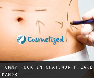 Tummy Tuck in Chatsworth Lake Manor