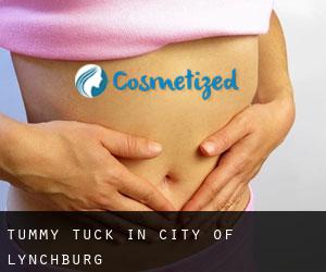 Tummy Tuck in City of Lynchburg