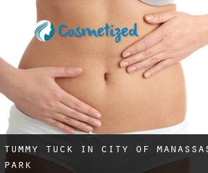 Tummy Tuck in City of Manassas Park
