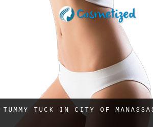 Tummy Tuck in City of Manassas