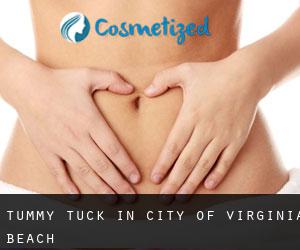Tummy Tuck in City of Virginia Beach
