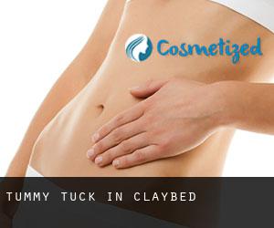 Tummy Tuck in Claybed