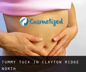 Tummy Tuck in Clayton Ridge North