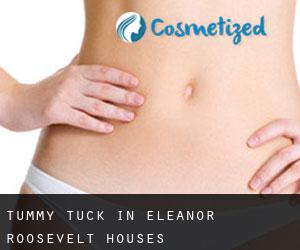 Tummy Tuck in Eleanor Roosevelt Houses
