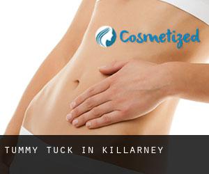 Tummy Tuck in Killarney