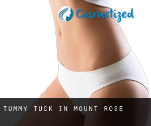 Tummy Tuck in Mount Rose