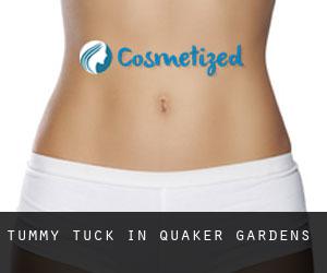 Tummy Tuck in Quaker Gardens