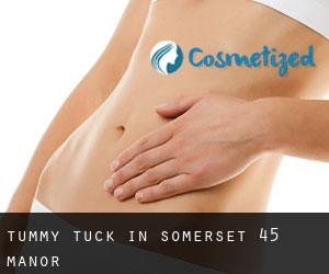 Tummy Tuck in Somerset 45 Manor