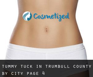 Tummy Tuck in Trumbull County by city - page 4