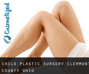 Chilo plastic surgery (Clermont County, Ohio)