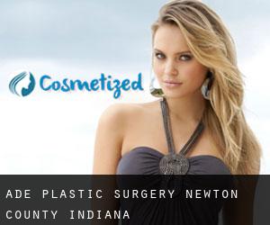 Ade plastic surgery (Newton County, Indiana)