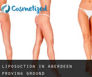 Liposuction in Aberdeen Proving Ground