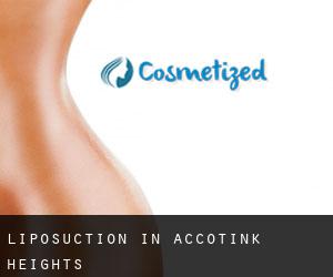 Liposuction in Accotink Heights