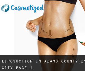 Liposuction in Adams County by city - page 1